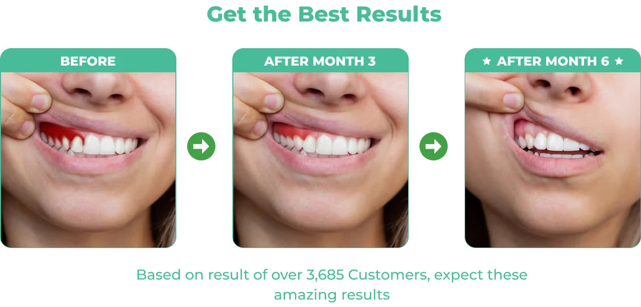 dentitox pro Natural Oral Health Supplement